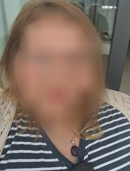 Feline, 23